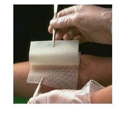 GARZA MEDICATA BACTIGRAS CON CLOREXIDINA ACETATO 0,5% 10X10CM 10 PEZZI - Angeli Pharm