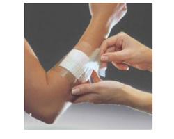 FILM ADESIVO IN POLIURETANO OPSITE FLEXIFIX IN ROTOLO TRASPARENTE IMPERMEABILE PER FISSAGGIO DI MEDICAZIONI E CATETERI LARGHEZZA 15 CM LUNGHEZZA 10 M 1 PEZZO - Angeli Pharm